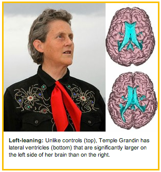 Illustration for article titled Temple Grandin has a brain like no one else's